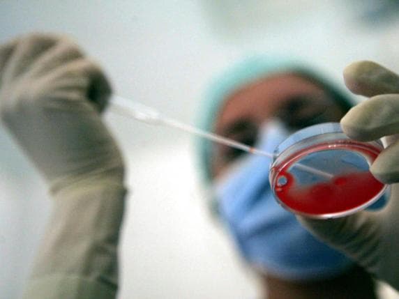 Milano, dopo lo scambio di embrioni l'Ats intensifica i controlli su tutti gli ospedali. Solo tre centri dotati del sistema hi-tech anti-errore