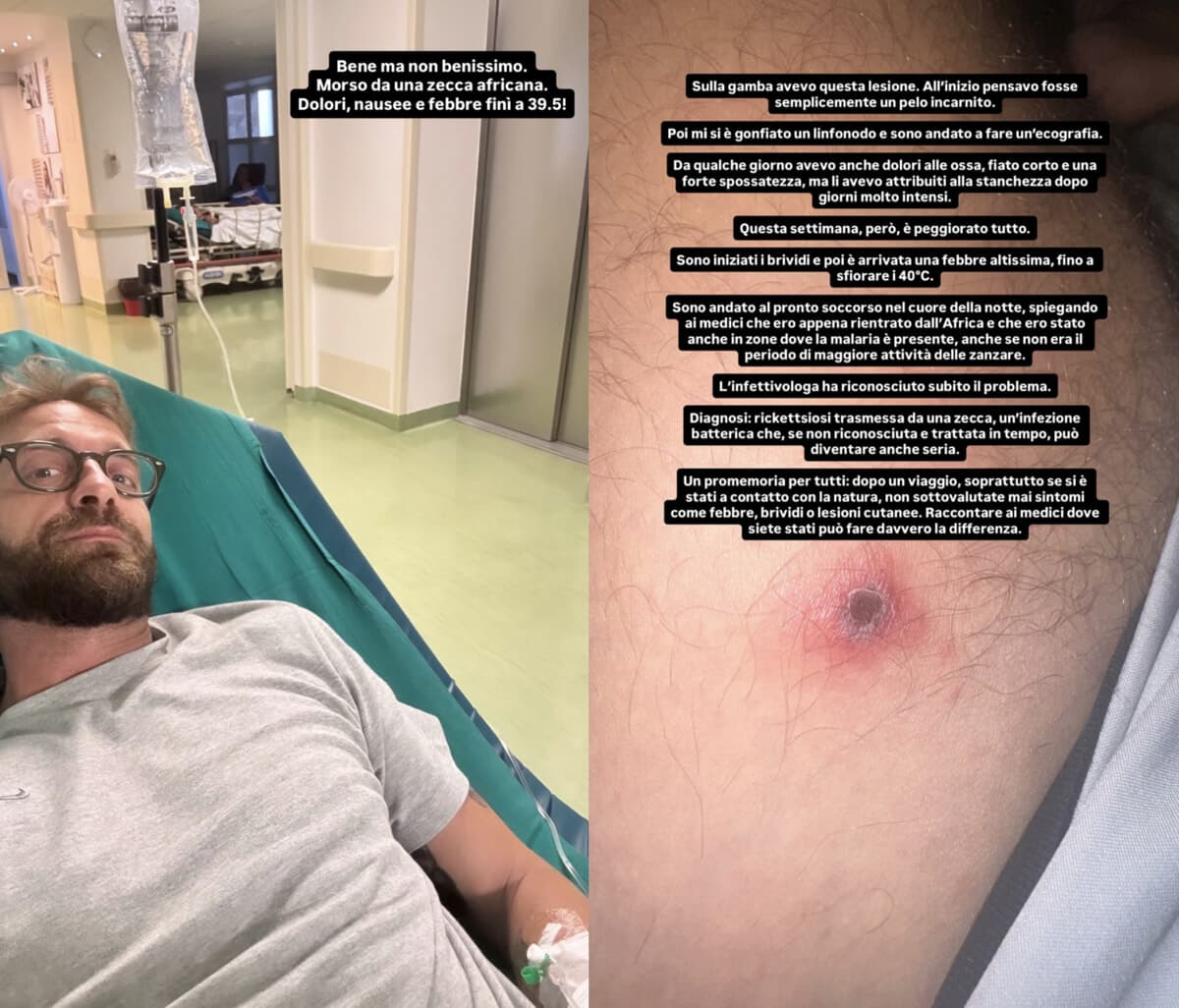 "Pensava fosse un pelo incarnito": corsa in ospedale nella notte per l'inviato delle Iene Stefano Corti