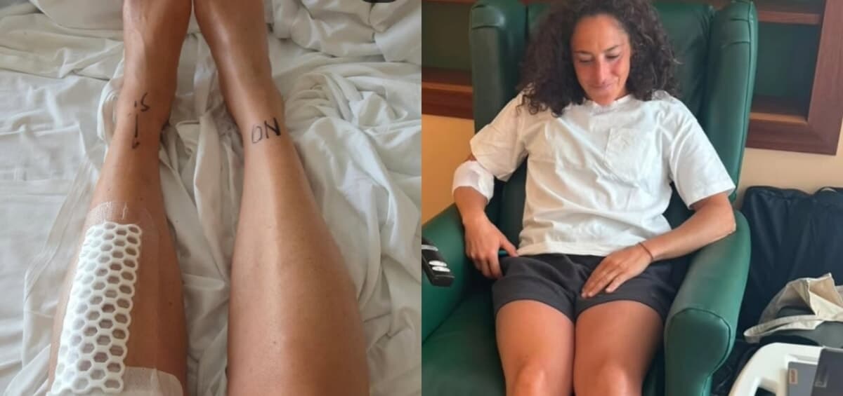 Federica Brignone dimessa dopo l'operazione a Milano: "Sto bene, tolte placca e viti"