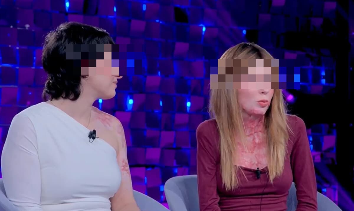 Sofia Donadio e Francesca Nota: "Subìto più di 50 interventi, in coma per un mese: ma il fuoco non ci ha tolto la voglia di vivere"