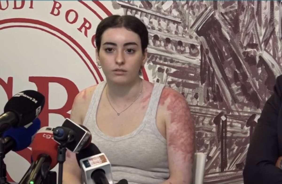 Sofia Donadio, 16enne sopravvissuta al rogo di Crans Montana: "I medici mi hanno detto di sorridere e non deprimermi"