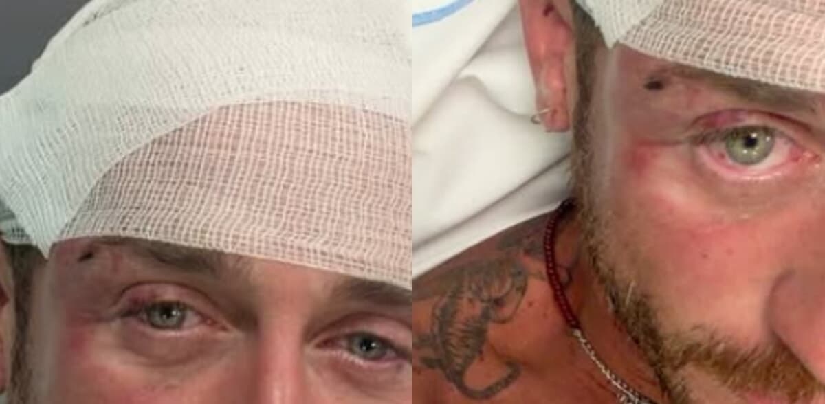 “Trascinato per terra e colpito da 30 persone con pugni e pietre”. Angelo Ratti, promoter milanese, denuncia aggressione omofoba