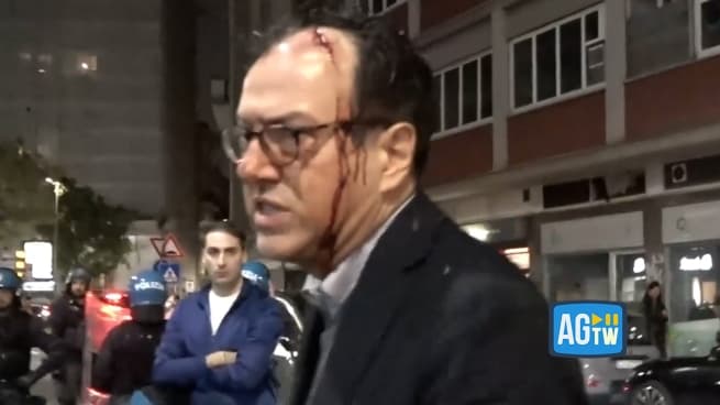 Il dirigente della polizia ferito alla testa e un agente mostra una pietra: «Queste ci hanno tirato»